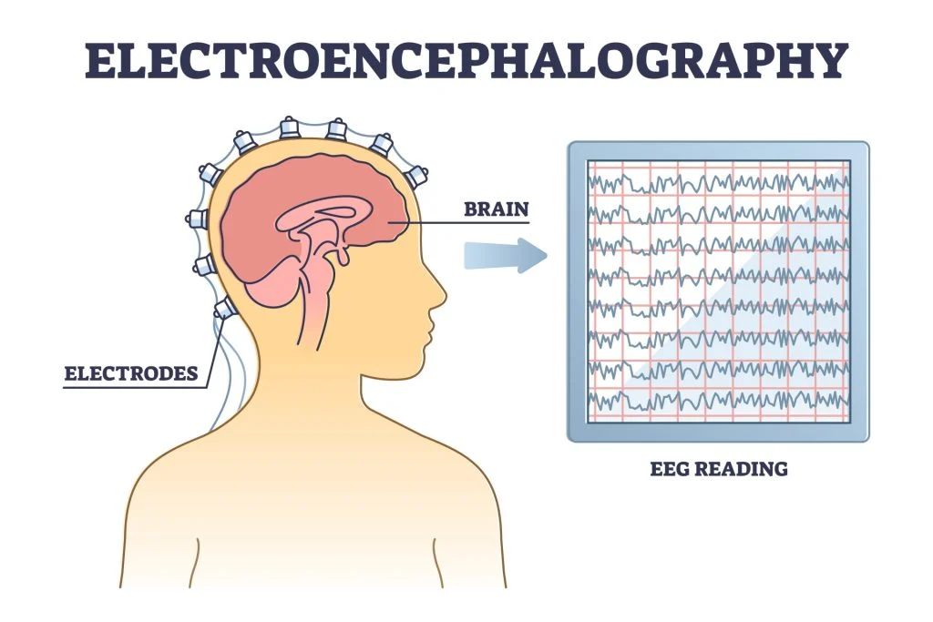 Process of EEG Detection